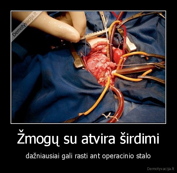 Žmogų su atvira širdimi - dažniausiai gali rasti ant operacinio stalo