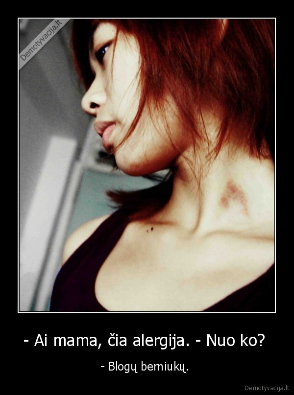 - Ai mama, čia alergija. - Nuo ko?  - - Blogų berniukų. . 