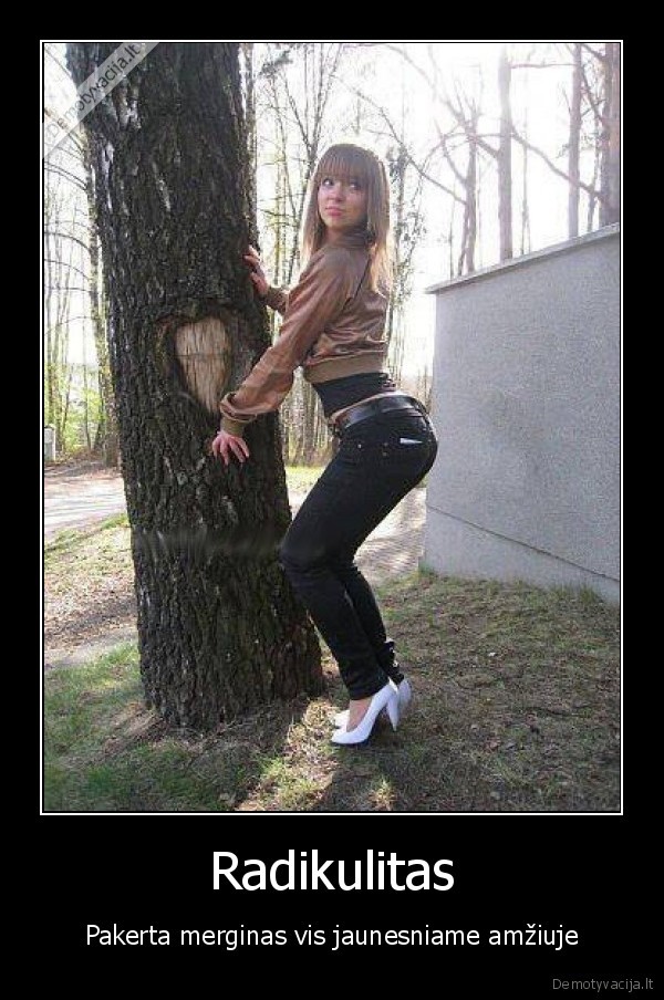 Radikulitas - Pakerta merginas vis jaunesniame amžiuje. 