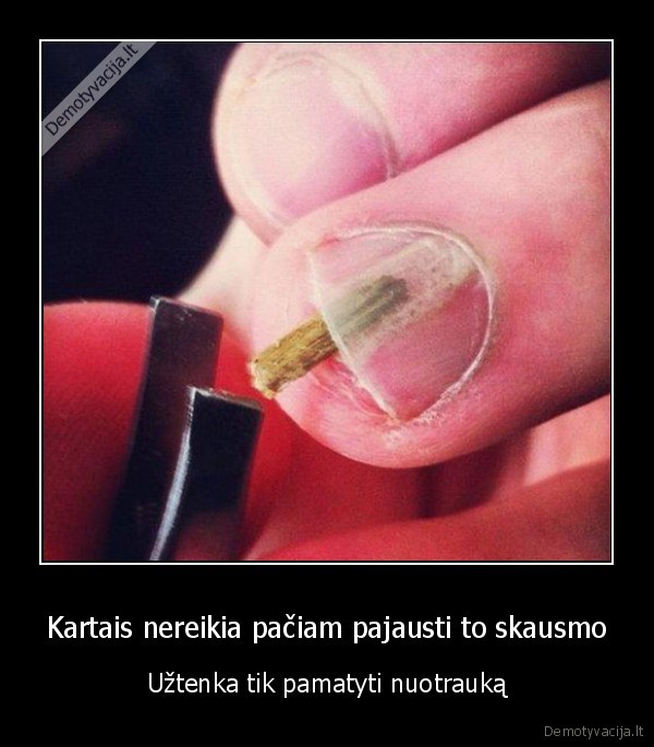 Kartais nereikia pačiam pajausti to skausmo - Užtenka tik pamatyti nuotrauką. 