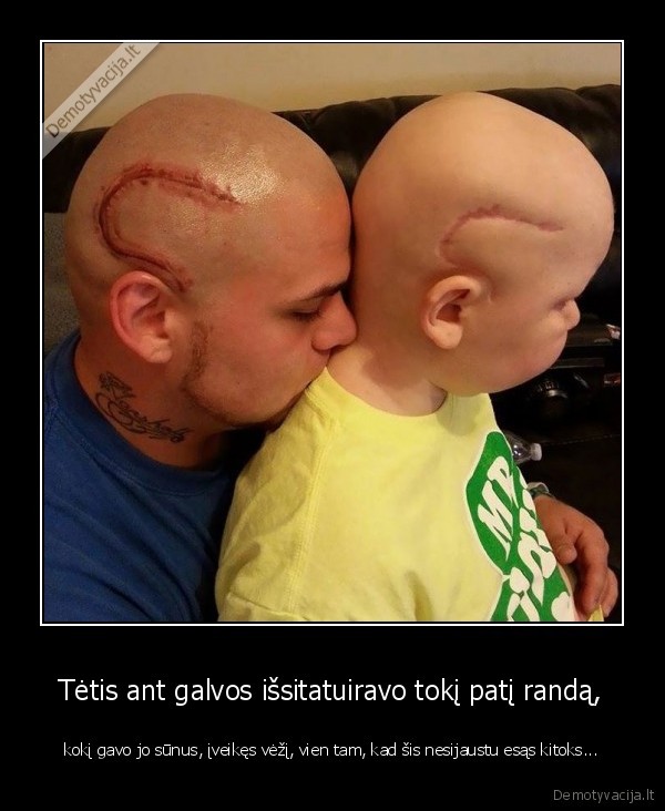 Tėtis ant galvos išsitatuiravo tokį patį randą, - kokį gavo jo sūnus, įveikęs vėžį, vien tam, kad šis nesijaustu esąs kitoks.... 
