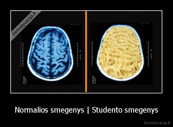 Normalios smegenys | Studento smegenys. 