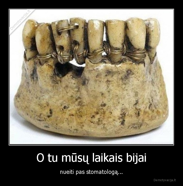 O tu mūsų laikais bijai - nueiti pas stomatologą.... 