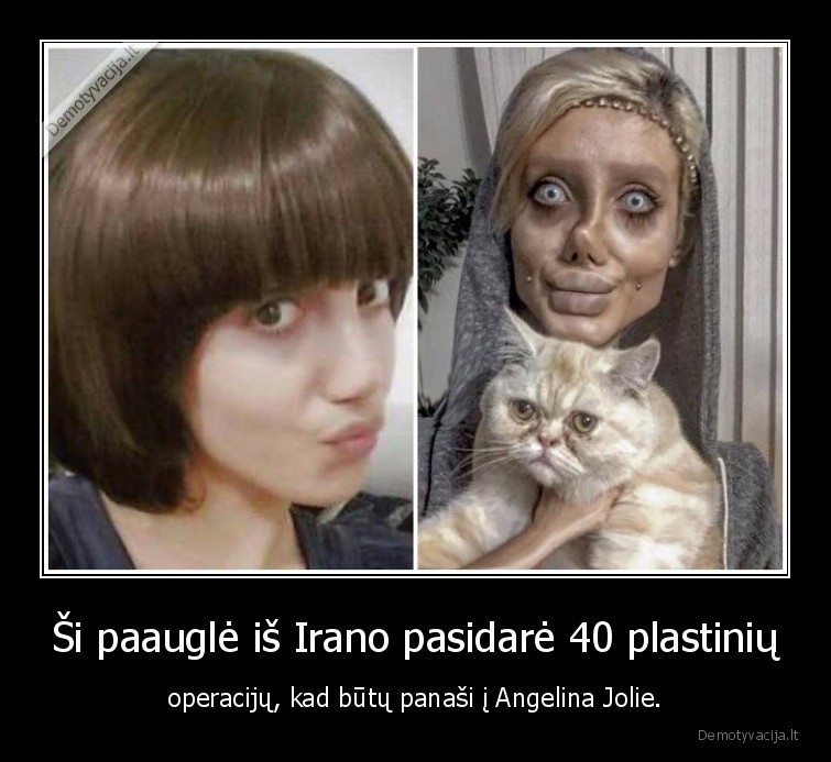 Ši paauglė iš Irano pasidarė 40 plastinių - operacijų, kad būtų panaši į Angelina Jolie.. 