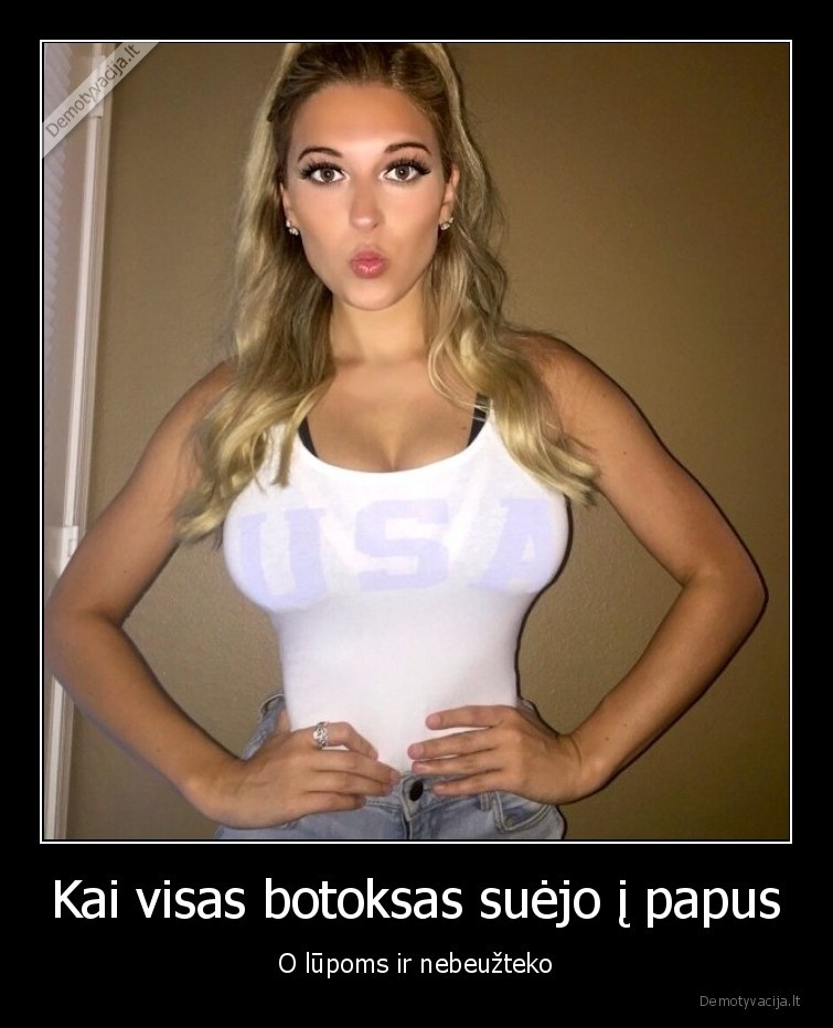 Kai visas botoksas suėjo į papus - O lūpoms ir nebeužteko. 