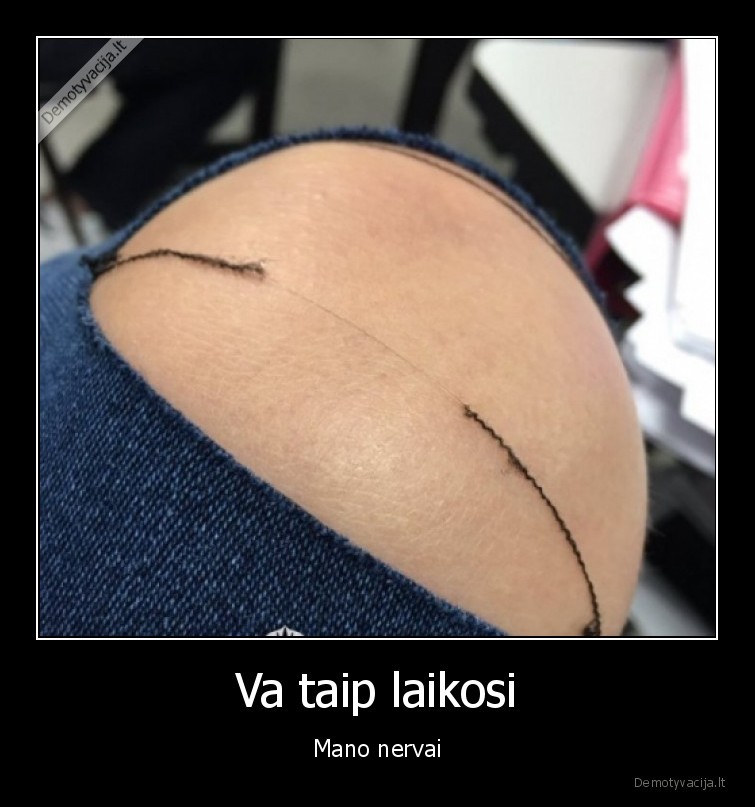 Va taip laikosi - Mano nervai. 