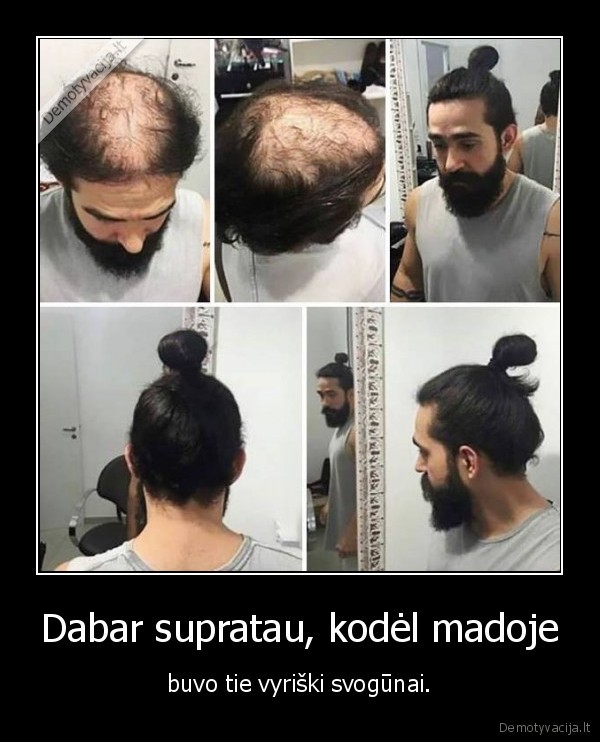 Dabar supratau, kodėl madoje - buvo tie vyriški svogūnai.. 