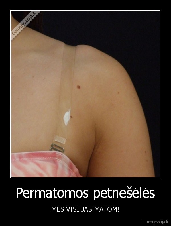 Permatomos petnešėlės - MES VISI JAS MATOM!. 