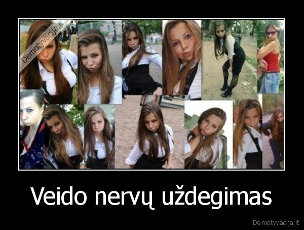 Veido nervų uždegimas. 